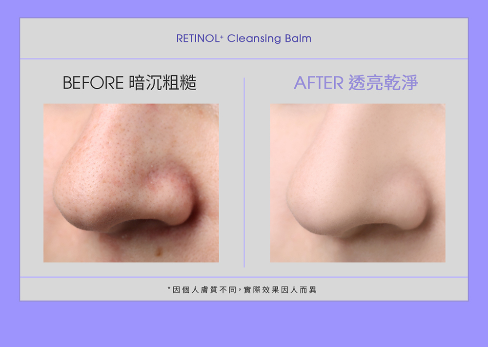 RETINOL Cleansing BalmBEFORE 暗沉粗糙AFTER 透亮乾淨* 因個人膚質不同,實際效果因人而異